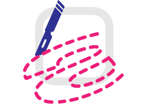 Trimming Options- 103 | Trimming Options- 102